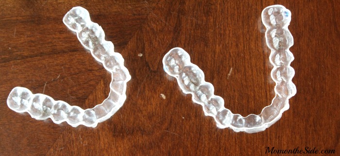 It Starts With a Smile: Starting Invisalign Teen